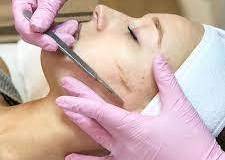 dermaplaning-1